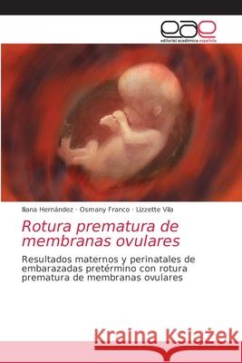 Rotura prematura de membranas ovulares Hern Osmany Franco Lizzette Vila 9786203037241 Editorial Academica Espanola - książka