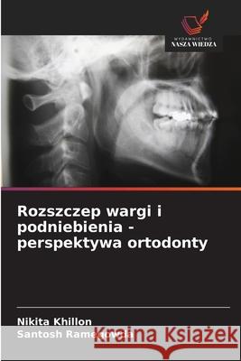 Rozszczep wargi i podniebienia - perspektywa ortodonty Khillon, Nikita, Ramegowda, Santosh 9786208816902 Wydawnictwo Nasza Wiedza - książka