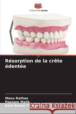 Résorption de la crête édentée Rathee, Manu, Malik, Poonam, Tamrakar, Amit Kumar 9786209226984 Editions Notre Savoir - książka