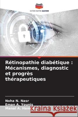 Rétinopathie diabétique : Mécanismes, diagnostic et progrès thérapeutiques Nasr, Noha N., Younis, Eman A., Hamed, Manal A. 9786208463571 Editions Notre Savoir - książka