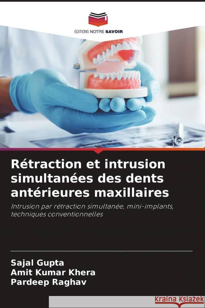 Rétraction et intrusion simultanées des dents antérieures maxillaires Gupta, Sajal, Khera, Amit Kumar, Raghav, Pardeep 9786204608419 Editions Notre Savoir - książka