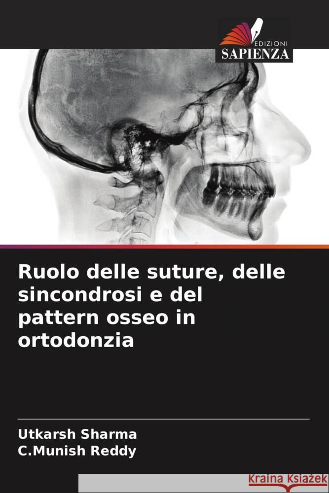 Ruolo delle suture, delle sincondrosi e del pattern osseo in ortodonzia Utkarsh Sharma C. Munish Reddy 9786206961406 Edizioni Sapienza - książka