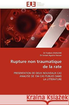 Rupture Non Traumatique de la Rate Collectif 9786131522314 Omniscriptum - książka