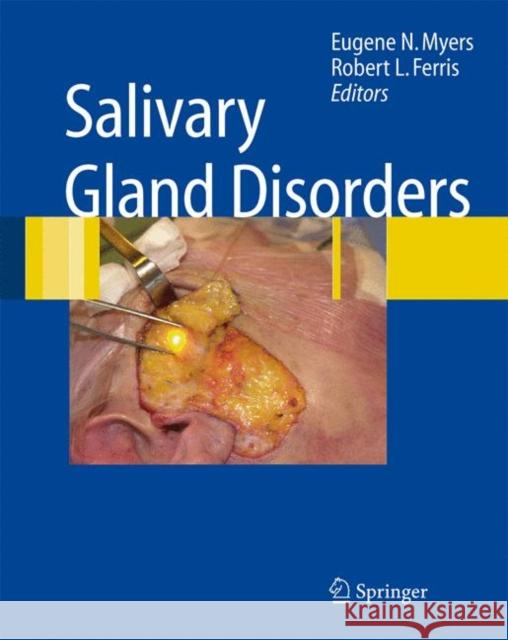 Salivary Gland Disorders Eugene N. Myers Robert L. Ferris 9783540470700 Springer - książka