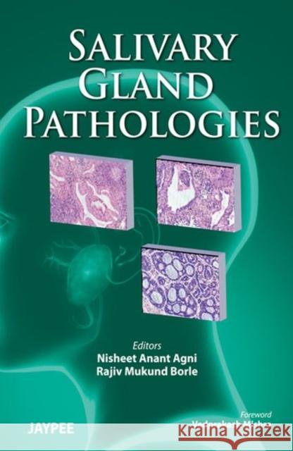 Salivary Gland Pathologies  9789380704722 Jaypee Brothers Medical Publishers - książka