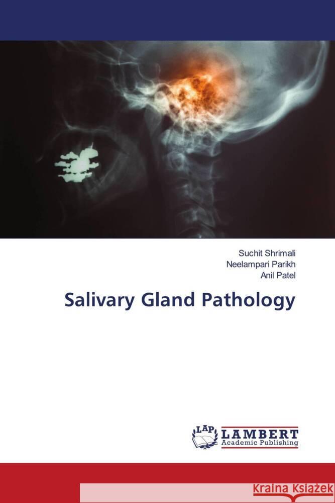 Salivary Gland Pathology Shrimali, Suchit, Parikh, Neelampari, Patel, Anil 9786205516997 LAP Lambert Academic Publishing - książka