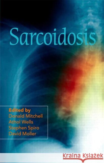 Sarcoidosis DrDonald Mitchell 9780340992111  - książka