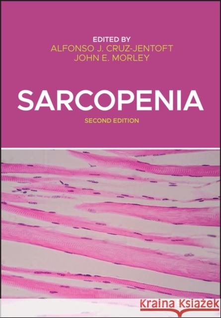 Sarcopenia Alfonso A. Cruz-Jentoft John E. Morley 9781119597872 Wiley-Blackwell - książka