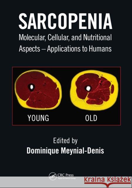 Sarcopenia: Molecular, Cellular, and Nutritional Aspects - Applications to Humans Dominique Meynial-Denis 9781032084282 CRC Press - książka