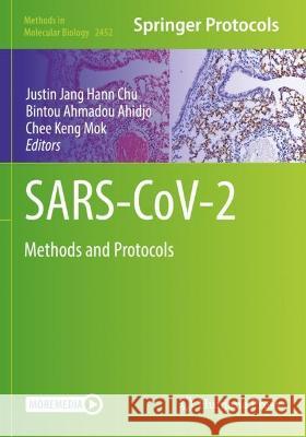 SARS-CoV-2  9781071621134 Springer US - książka