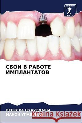 SBOI V RABOTE IMPLANTATOV Chaudhary, Deeksha, Upadhyay, Manoj 9786206083955 Sciencia Scripts - książka
