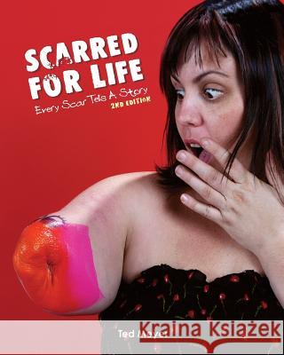 Scarred for Life. 2nd Edition: Every Scar Tells A Story Ted Meyer 9781985007321 Createspace Independent Publishing Platform - książka