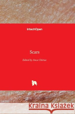 Scars Anca Chiriac 9781838809348 IntechOpen - książka