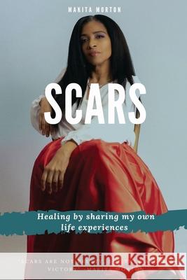 Scars: Healing by sharing my own life experiences Makita Morton 9781977228208 Outskirts Press - książka