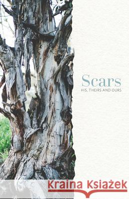 Scars: His, Theirs and Ours Gardner Hall 9780985005948 Mount Bethel Publishing - książka