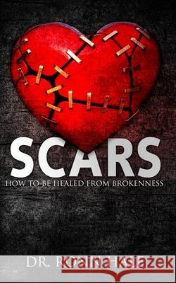 Scars: How to Be Healed from Brokenness Ronn Hale 9781916179189 Grace House Publishing - książka