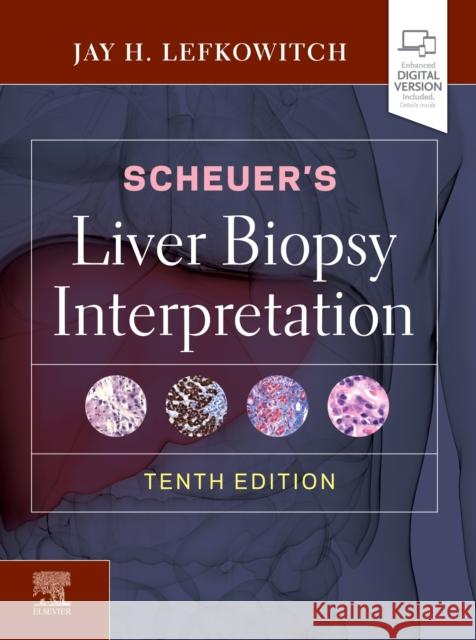 Scheuer's Liver Biopsy Interpretation Jay H. Lefkowitch 9780702075841 Elsevier - książka