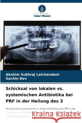 Schicksal von lokalen vs. systemischen Antibiotika bei PRF in der Heilung des 3 Lalchandani, Akshim Sukhraj, DEV, SACHIN 9783330846739 Verlag Unser Wissen - książka