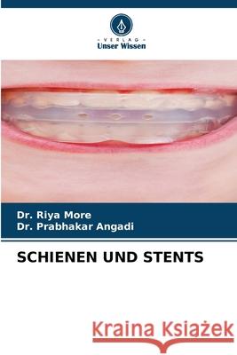 Schienen Und Stents Riya More Prabhakar Angadi 9786207779697 Verlag Unser Wissen - książka