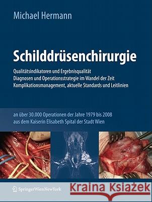 Schilddrüsenchirurgie - Qualitätsindikatoren Und Ergebnisqualität, Diagnosen Und Operationsstrategie Im Wandel Der Zeit, Komplikationsmanagement, Aktu Hermann, Michael 9783709103968 Not Avail - książka