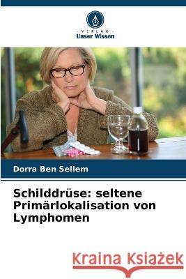 Schilddruse: seltene Primarlokalisation von Lymphomen Dorra Ben Sellem   9786205817445 Verlag Unser Wissen - książka