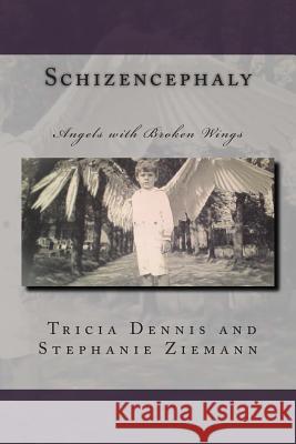 Schizencephaly Tricia Dennis Stephanie Ziemann 9781483936604 Createspace - książka