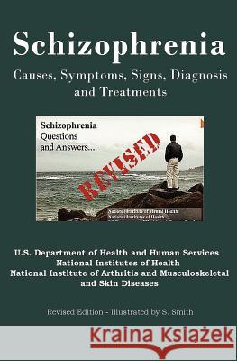 Schizophrenia: Causes, Symptoms, Signs, Diagnosis and Treatments - Revised Edition - Illustrated by S. Smith National Institut Department of Health and Human 9781469986746 Createspace - książka