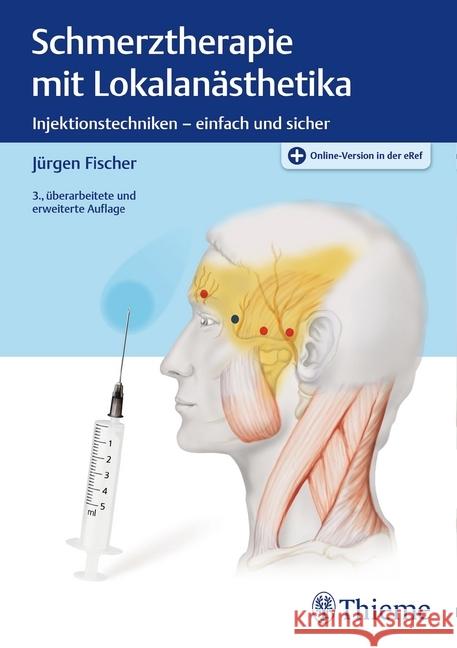 Schmerztherapie mit Lokalanästhetika : Injektionstechniken - einfach und sicher. Plus Online-Version in der eRef Fischer, Jürgen 9783131179333 Thieme, Stuttgart - książka