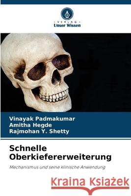 Schnelle Oberkiefererweiterung Padmakumar, Vinayak, Hegde, Amitha, Shetty, Rajmohan Y. 9786209027710 Verlag Unser Wissen - książka