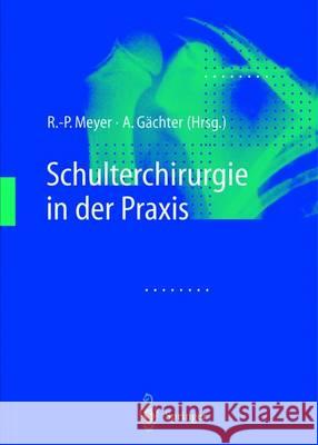 Schulterchirurgie in Der Praxis Meyer, R. -P 9783642630835 Springer - książka
