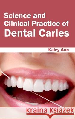 Science and Clinical Practice of Dental Caries Kaley Ann 9781632423603 Foster Academics - książka