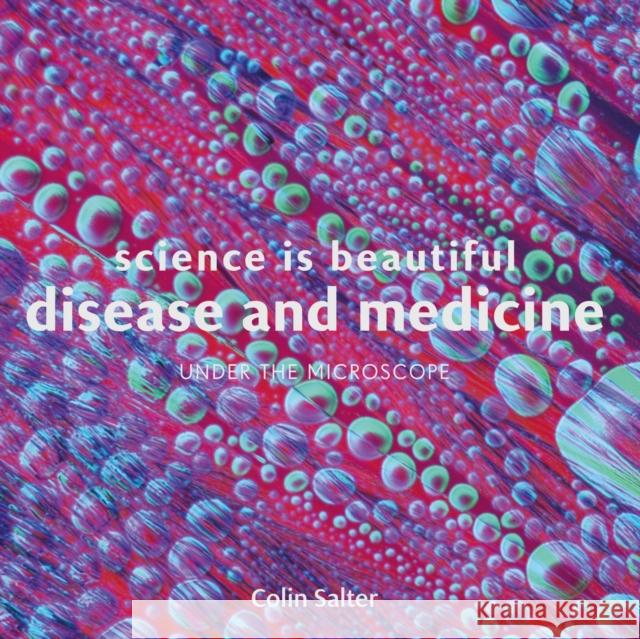 Science is Beautiful: Disease and Medicine: Under the Microscope Colin Salter 9781849944410 Batsford - książka