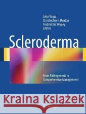 Scleroderma : From Pathogenesis to Comprehensive Management John Varga 9781441957733 Springer - książka