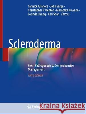 Scleroderma: From Pathogenesis to Comprehensive Management Yannick Allanore John Varga Christopher P. Denton 9783031406577 Springer - książka