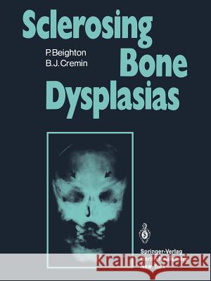 Sclerosing Bone Dysplasias P. Beighton B. J. Cremin H. G. Jacobson 9781447112945 Springer - książka