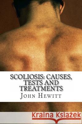 Scoliosis: Causes, Tests and Treatments John Hewit Mohamed Awa 9781466335301 Createspace - książka