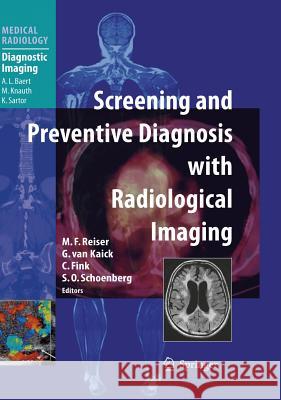 Screening and Preventive Diagnosis with Radiological Imaging Maximilian F. Reiser 9783540235538 Springer - książka