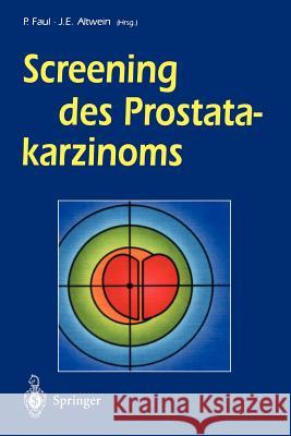 Screening Des Prostatakarzinoms Junkers, B. 9783642783197 Springer - książka