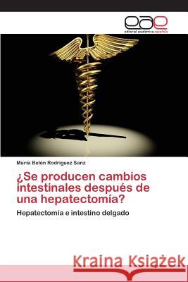 ¿Se producen cambios intestinales después de una hepatectomía? Rodríguez Sanz María Belén 9783659100215 Editorial Academica Espanola - książka