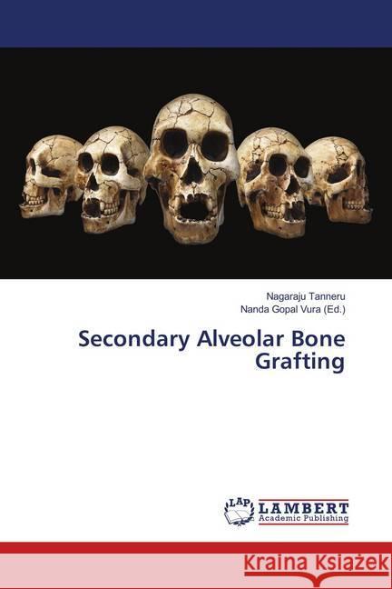 Secondary Alveolar Bone Grafting Tanneru, Nagaraju 9783659912764 LAP Lambert Academic Publishing - książka