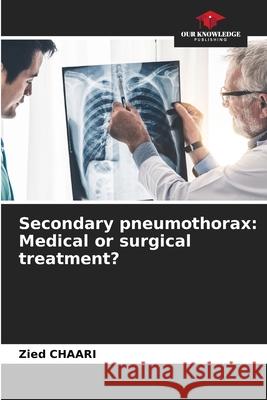 Secondary pneumothorax: Medical or surgical treatment? Chaari, Zied 9786209396878 Our Knowledge Publishing - książka