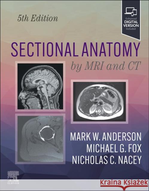 Sectional Anatomy by MRI and CT Mark W. Anderson Michael G. Fox Nicholas C. Nacey 9780323934480 Elsevier - książka