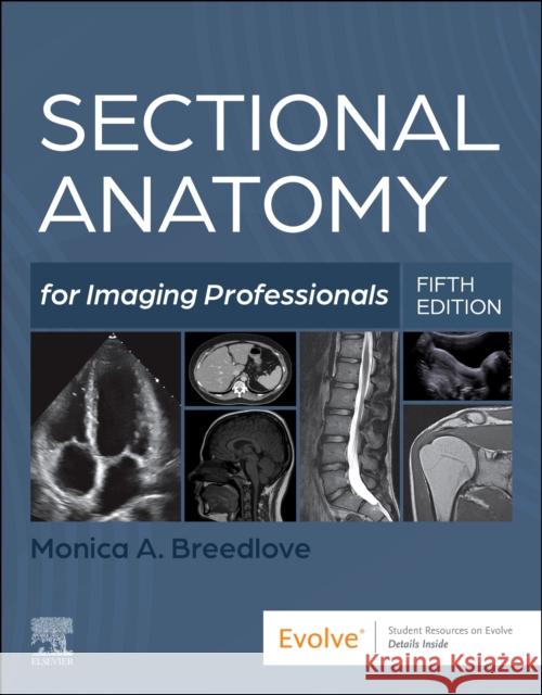 Sectional Anatomy for Imaging Professionals Monica, M.Ed., RT(R)(M)(CT)(MR) (Clinical Associate Professor, Boise State University, Boise, Idaho, USA) Breedlove 9780323827881 Mosby - książka