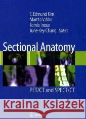 Sectional Anatomy: PET/CT and SPECT/CT Kim, E. Edmund 9780387382968 Springer - książka