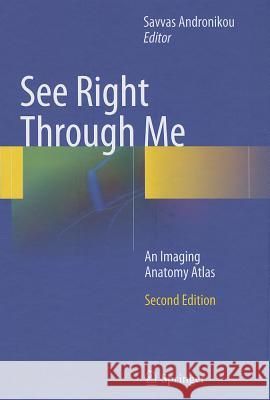 See Right Through Me: An Imaging Anatomy Atlas Andronikou, Savvas 9783642238925 Springer, Berlin - książka