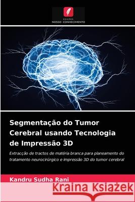 Segmentação do Tumor Cerebral usando Tecnologia de Impressão 3D Kandru Sudha Rani 9786204059563 Edicoes Nosso Conhecimento - książka