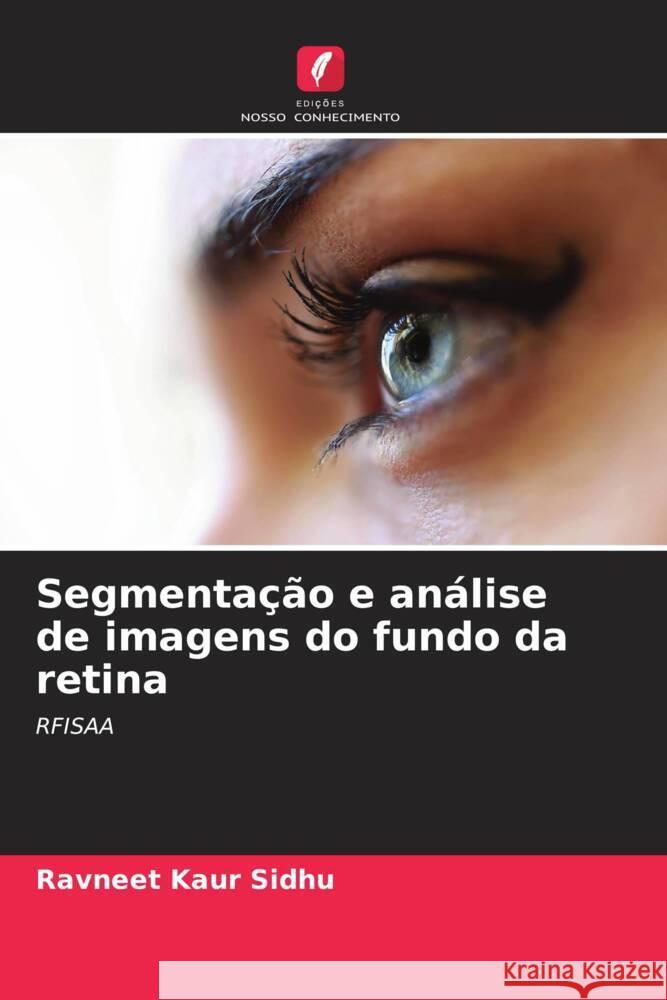 Segmenta??o e an?lise de imagens do fundo da retina Ravneet Kaur Sidhu 9786206664536 Edicoes Nosso Conhecimento - książka