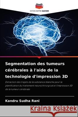 Segmentation des tumeurs cérébrales à l'aide de la technologie d'impression 3D Sudha Rani, Kandru 9786204059532 Editions Notre Savoir - książka