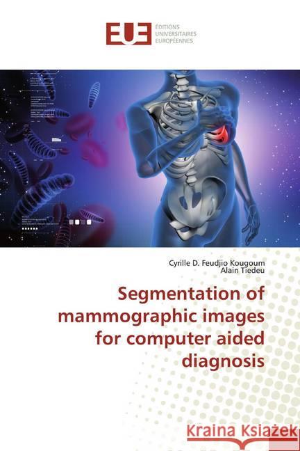 Segmentation of mammographic images for computer aided diagnosis Feudjio Kougoum, Cyrille D.; Tiedeu, Alain 9786138433095 Éditions universitaires européennes - książka