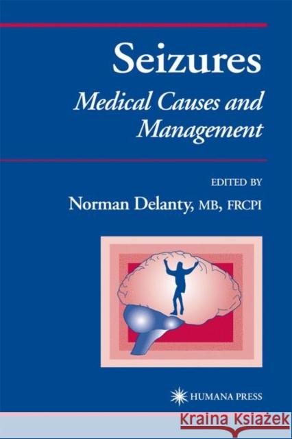 Seizures: Medical Causes and Management Delanty, Norman 9780896038271 Humana Press - książka